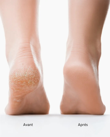 Vitalys Pro - Pédicure électrique nouvelle génération